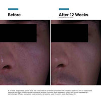 P-TIOX Anti-Wrinkle Cream