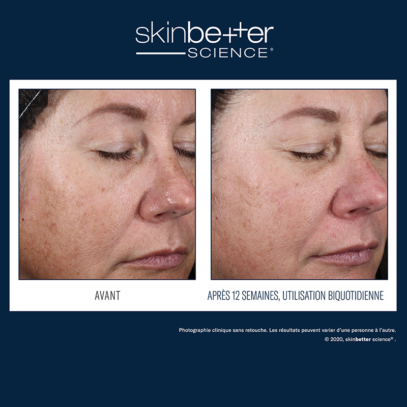 Alto Advanced Defense and Repair Serum 
