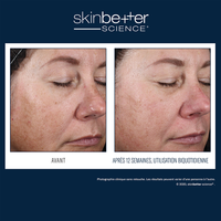 Alto Advanced Defense and Repair Serum 