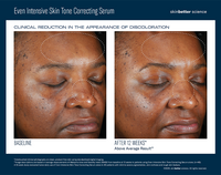 Even intensive skin tone correcting serum