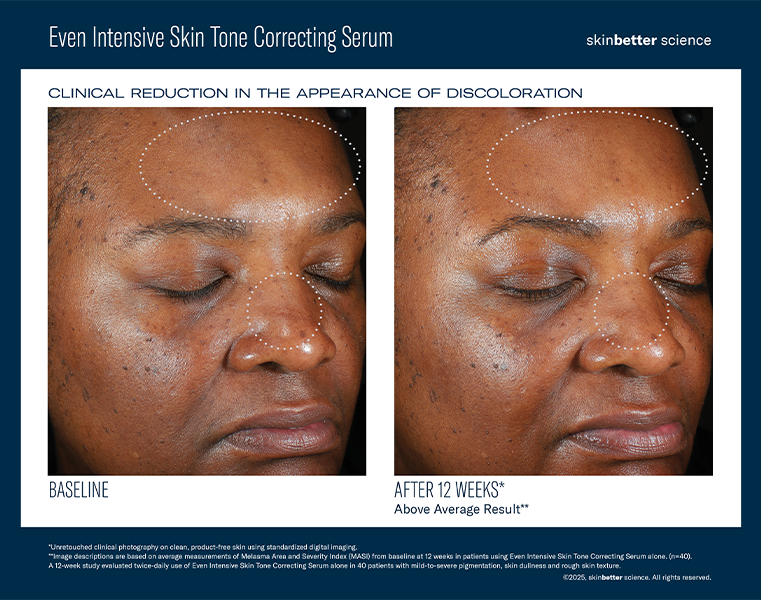 Even intensive skin tone correcting serum
