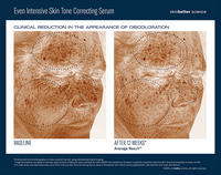 Even intensive skin tone correcting serum