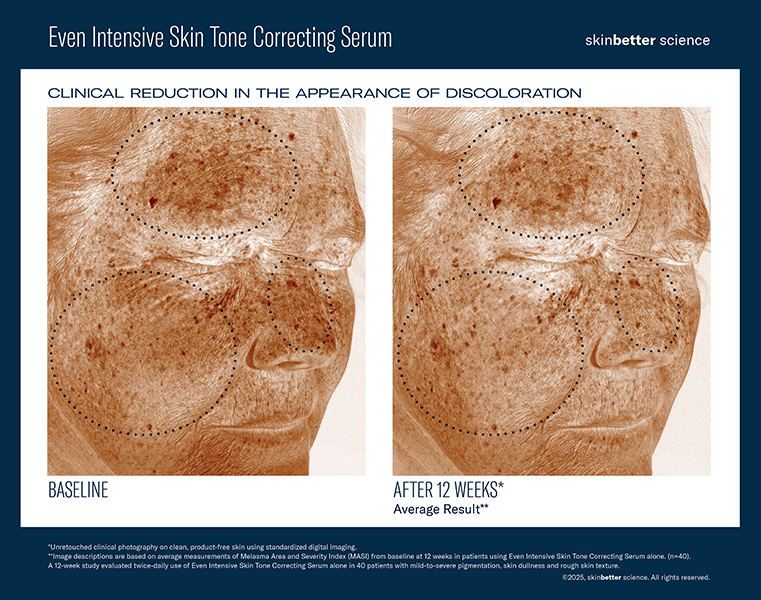Even intensive skin tone correcting serum