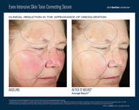 Even intensive skin tone correcting serum