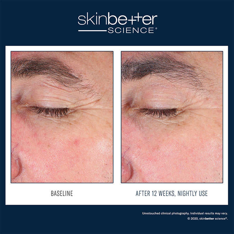 Eyemax alpharet overnight cream