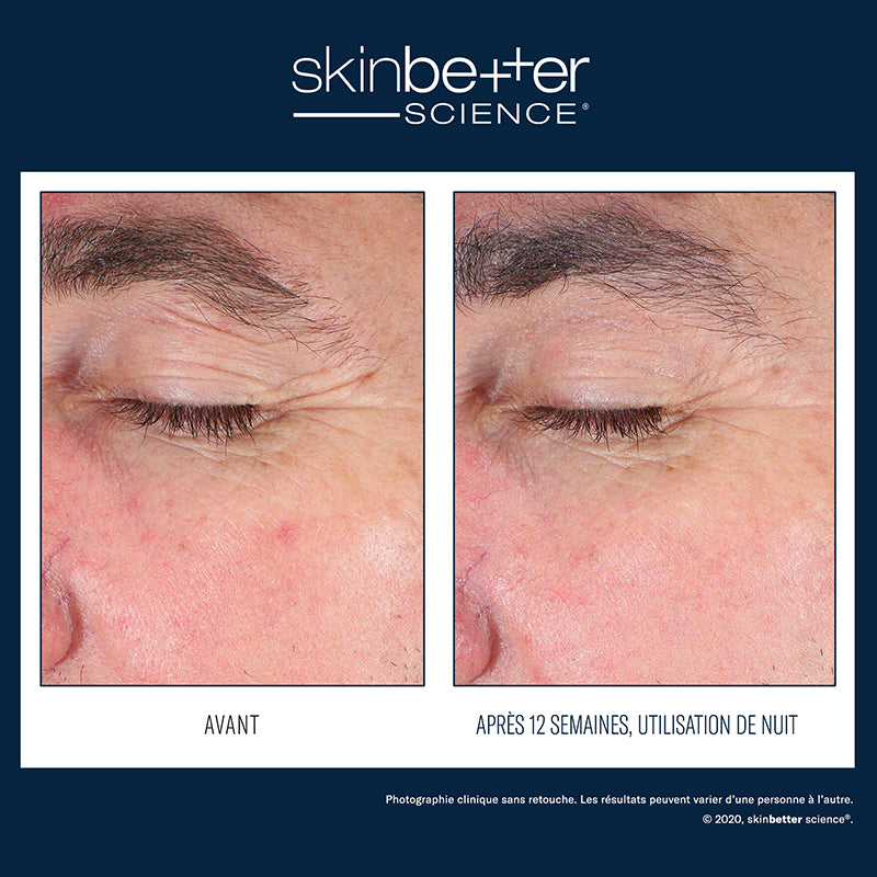 Eyemax alpharet overnight cream