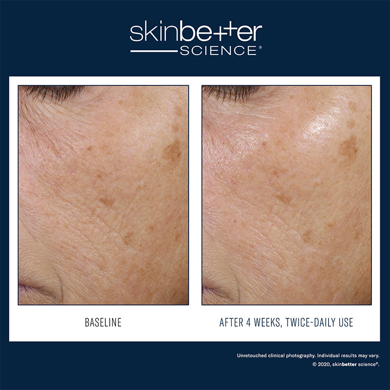 Trio rebalancing moisture treatment