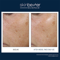Trio rebalancing moisture treatment
