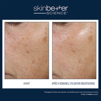 Trio rebalancing moisture treatment