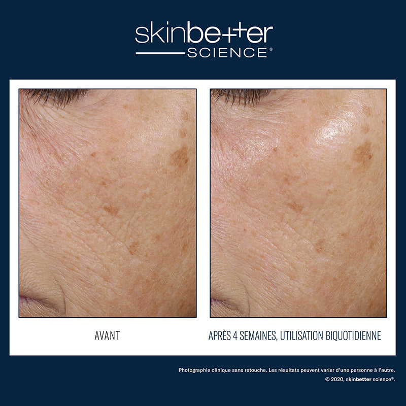 Trio rebalancing moisture treatment